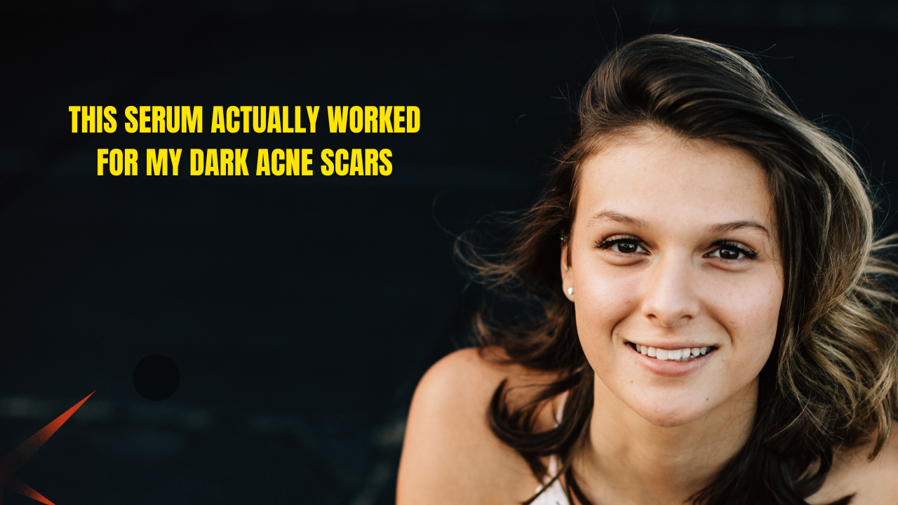 popular serums for fading post-acne scars